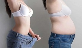 Best Liposuction before and after results
