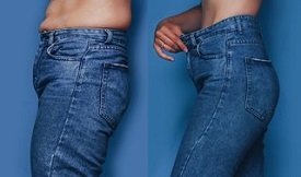 Liposuction before and after