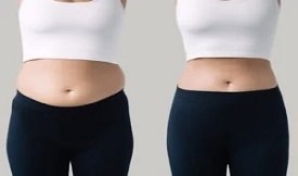 Best Wegovy injections in Islamabad