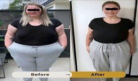 Munjaro Injection cost in Islamabad