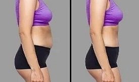 Wegovy injections before after results