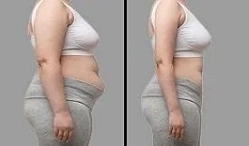Wegovy injections before after
